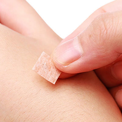 Αιχμηρή μύτη βελόνας από ανοξείδωτο χάλυβα για βελόνες βελονισμού ακριβείας